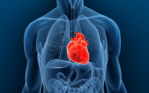 artificial heart